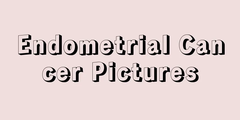 Endometrial Cancer Pictures