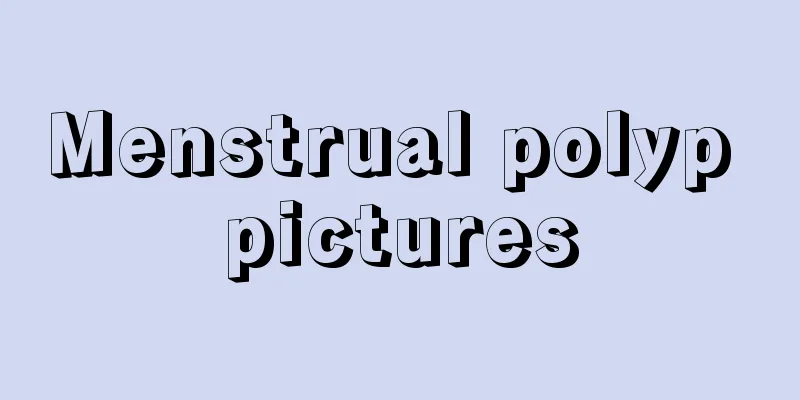 Menstrual polyp pictures