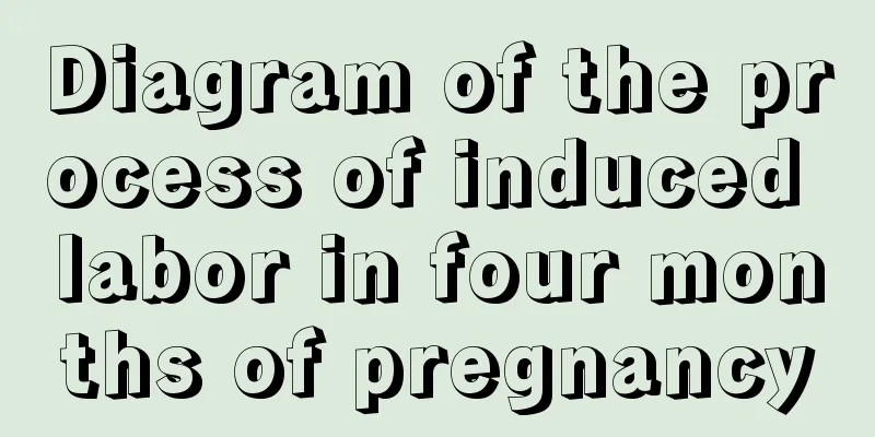 Diagram of the process of induced labor in four months of pregnancy