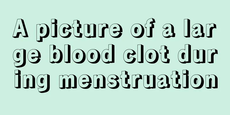 A picture of a large blood clot during menstruation