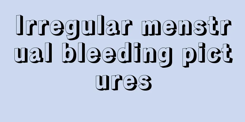 Irregular menstrual bleeding pictures