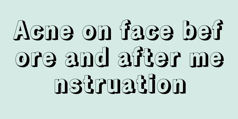 Acne on face before and after menstruation