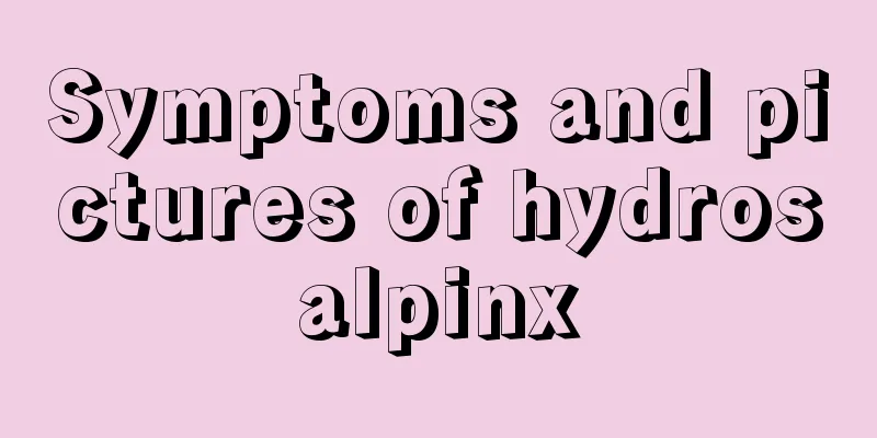 Symptoms and pictures of hydrosalpinx