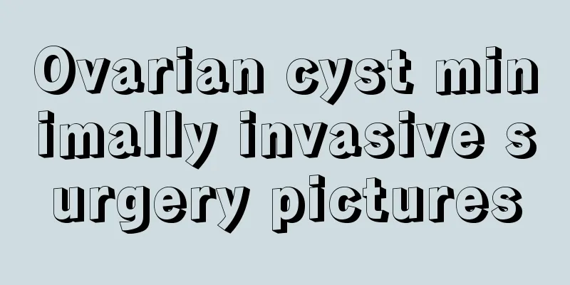 Ovarian cyst minimally invasive surgery pictures