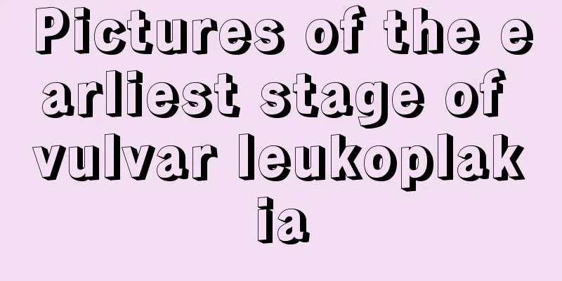 Pictures of the earliest stage of vulvar leukoplakia