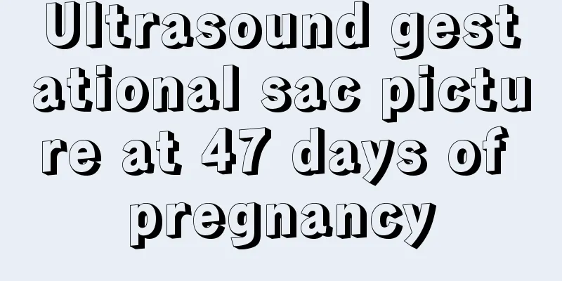 Ultrasound gestational sac picture at 47 days of pregnancy