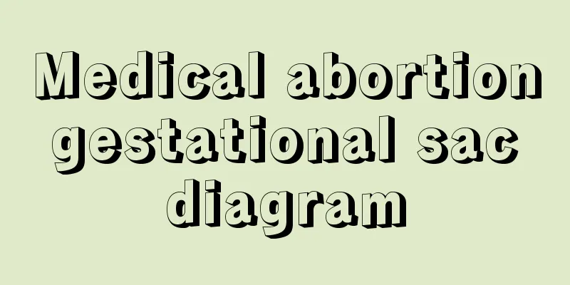 Medical abortion gestational sac diagram