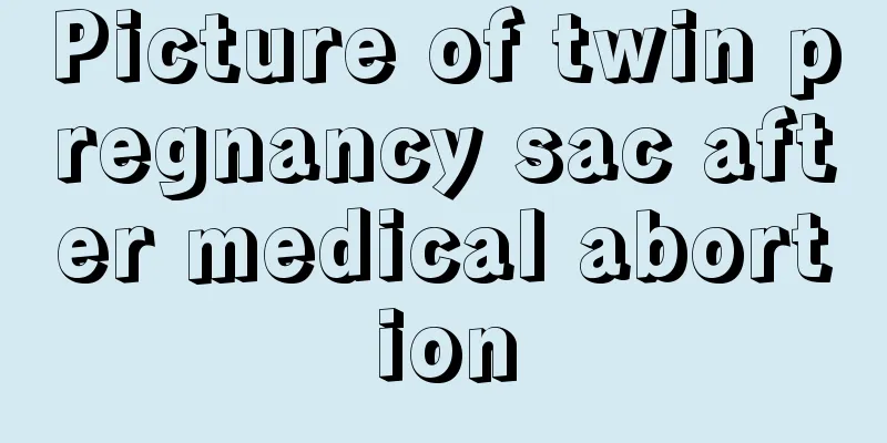 Picture of twin pregnancy sac after medical abortion