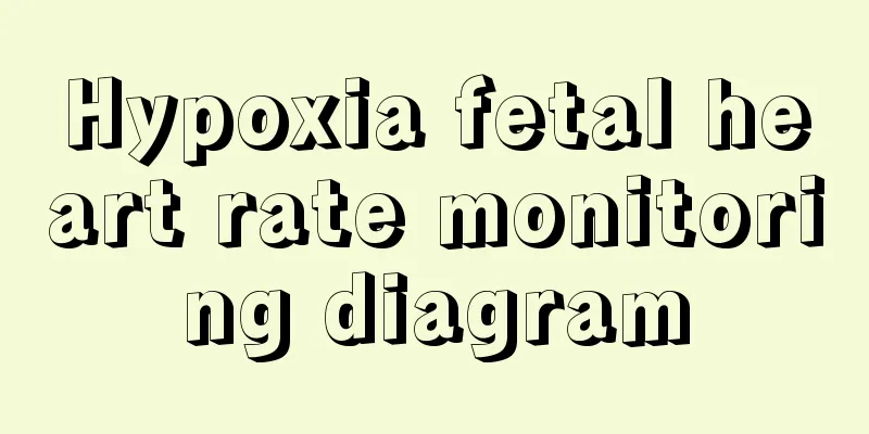 Hypoxia fetal heart rate monitoring diagram