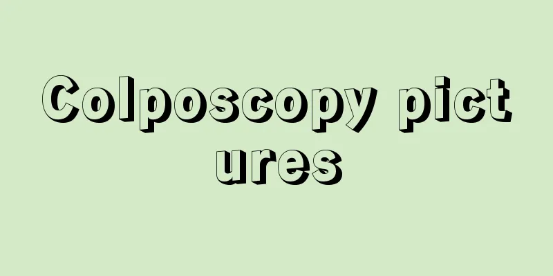 Colposcopy pictures