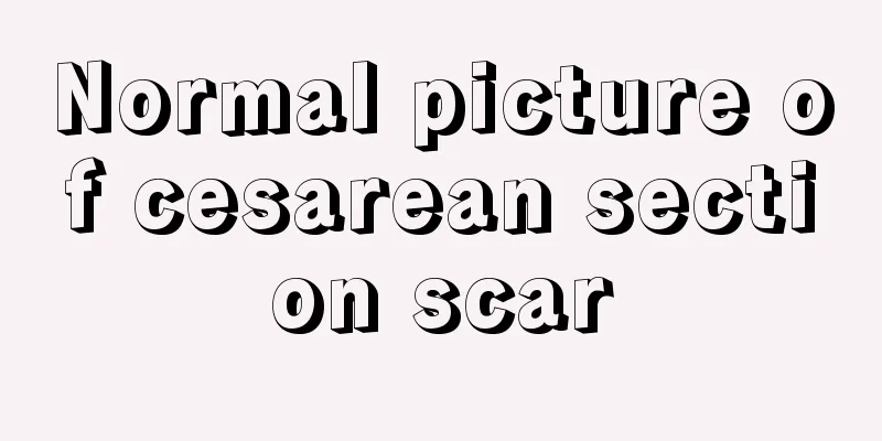 Normal picture of cesarean section scar