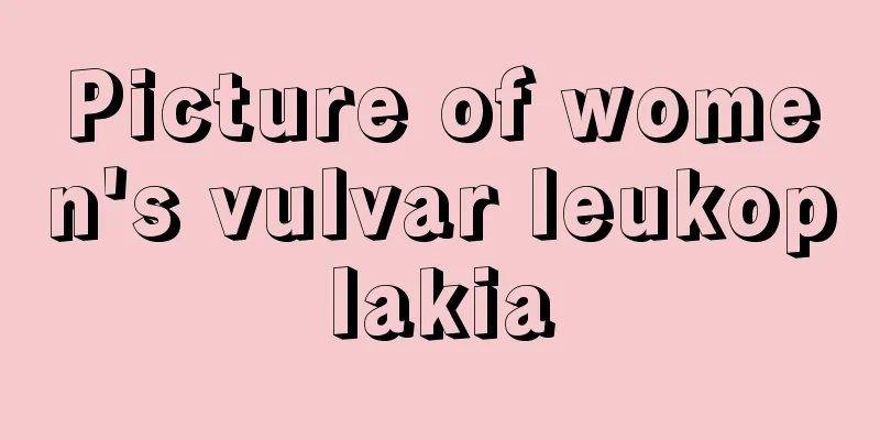 Picture of women's vulvar leukoplakia