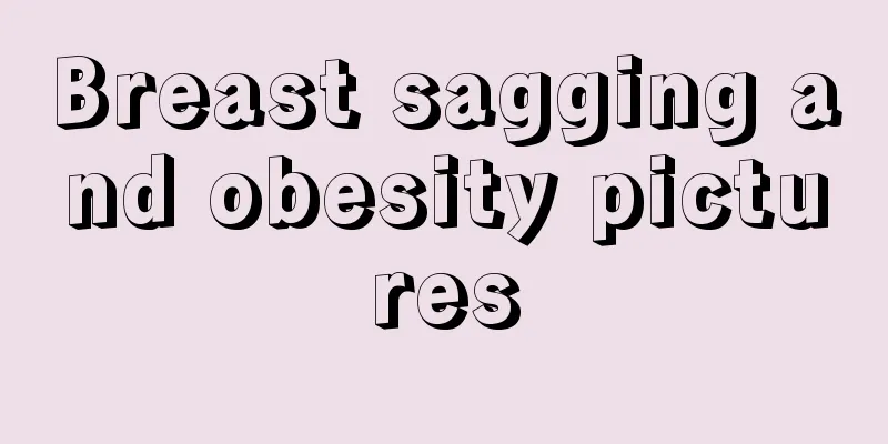 Breast sagging and obesity pictures