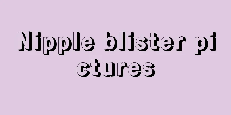 Nipple blister pictures