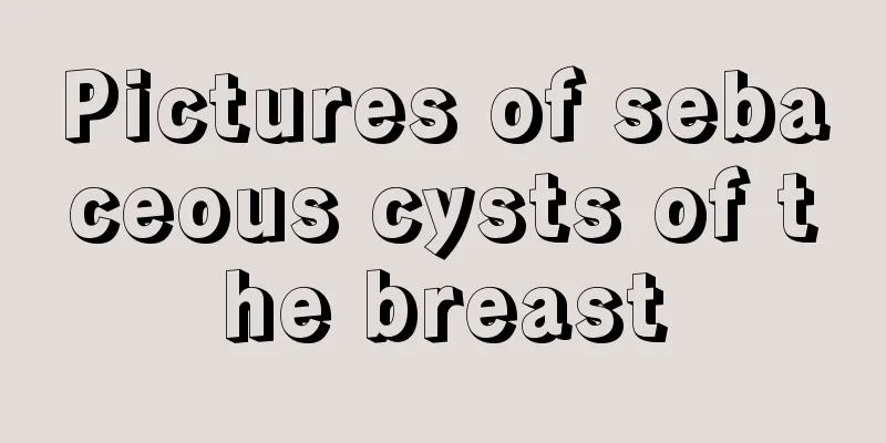 Pictures of sebaceous cysts of the breast