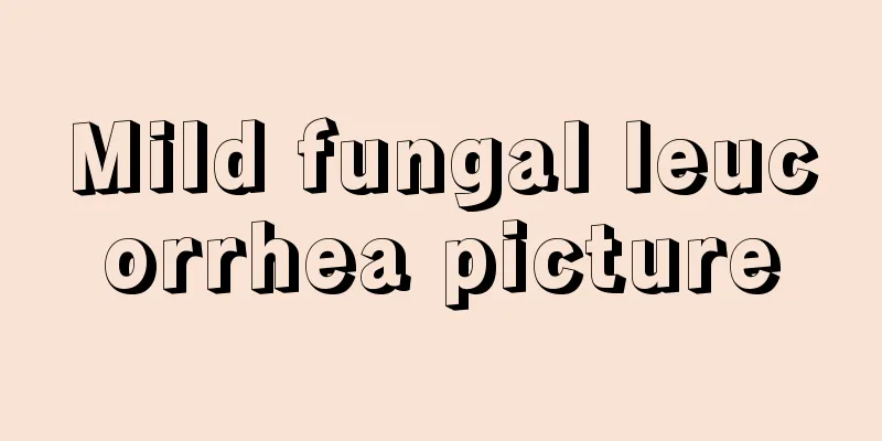 Mild fungal leucorrhea picture