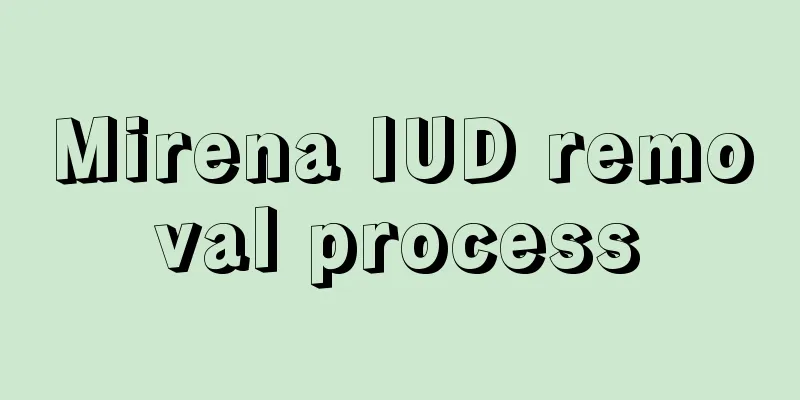 Mirena IUD removal process