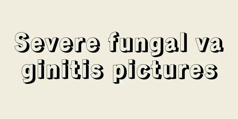 Severe fungal vaginitis pictures