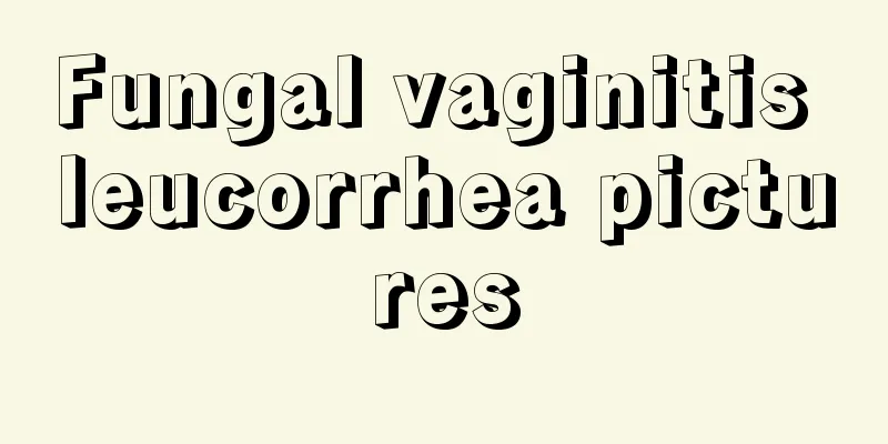 Fungal vaginitis leucorrhea pictures