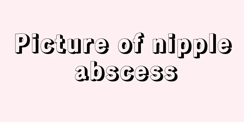 Picture of nipple abscess