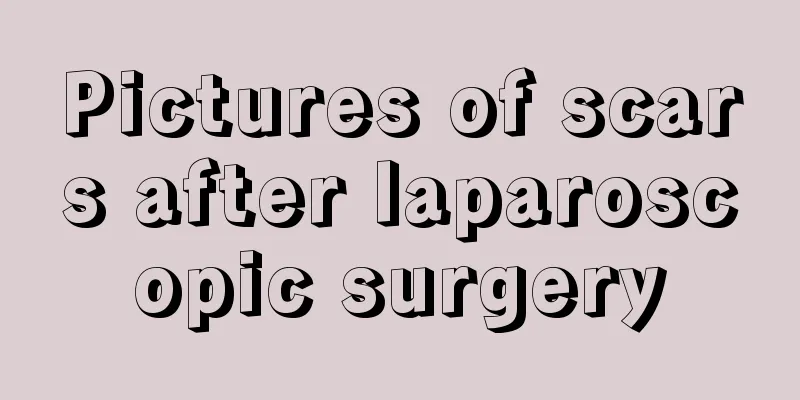 Pictures of scars after laparoscopic surgery