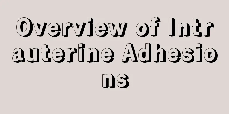 Overview of Intrauterine Adhesions