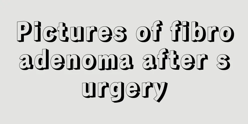 Pictures of fibroadenoma after surgery