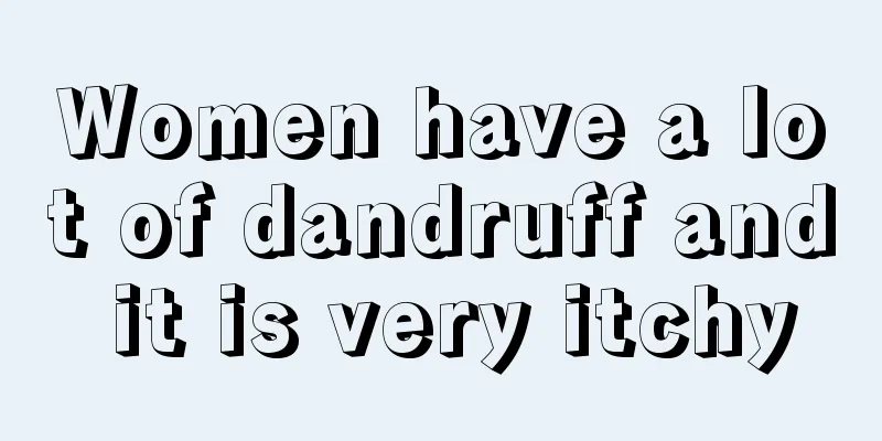 Women have a lot of dandruff and it is very itchy