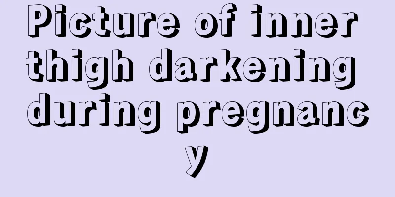 Picture of inner thigh darkening during pregnancy