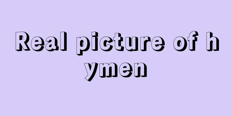 Real picture of hymen