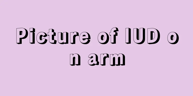 Picture of IUD on arm