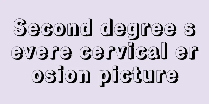 Second degree severe cervical erosion picture