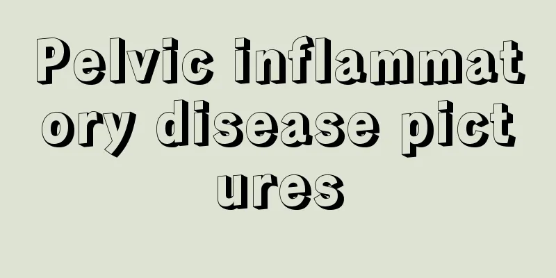 Pelvic inflammatory disease pictures