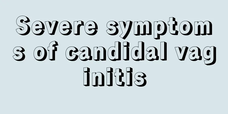 Severe symptoms of candidal vaginitis