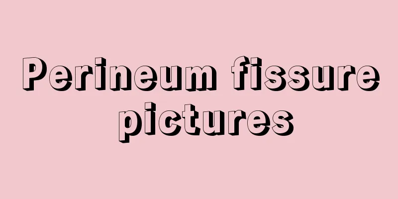 Perineum fissure pictures