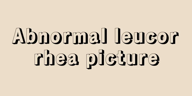 Abnormal leucorrhea picture