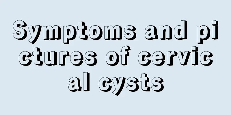 Symptoms and pictures of cervical cysts