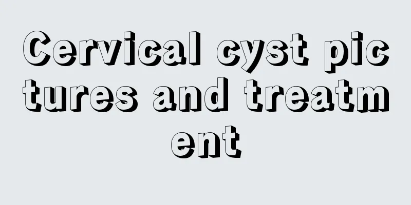 Cervical cyst pictures and treatment