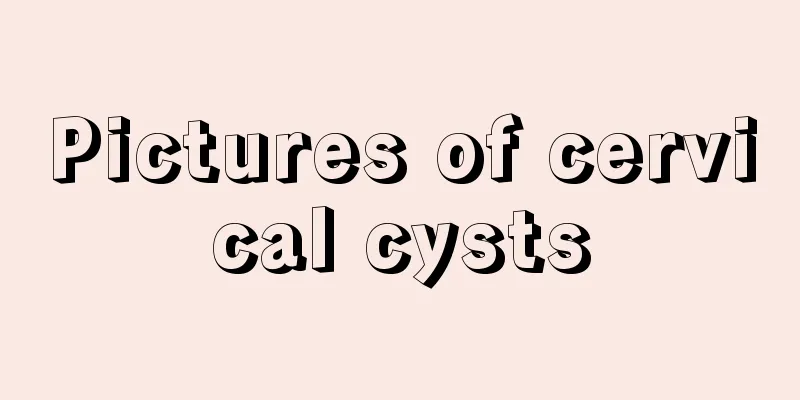 Pictures of cervical cysts