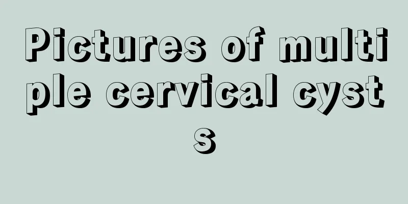 Pictures of multiple cervical cysts