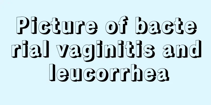 Picture of bacterial vaginitis and leucorrhea