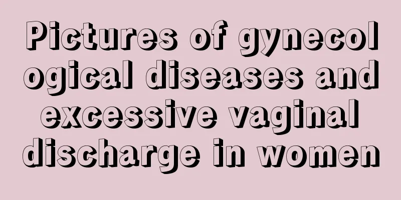 Pictures of gynecological diseases and excessive vaginal discharge in women