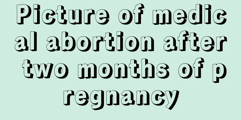 Picture of medical abortion after two months of pregnancy