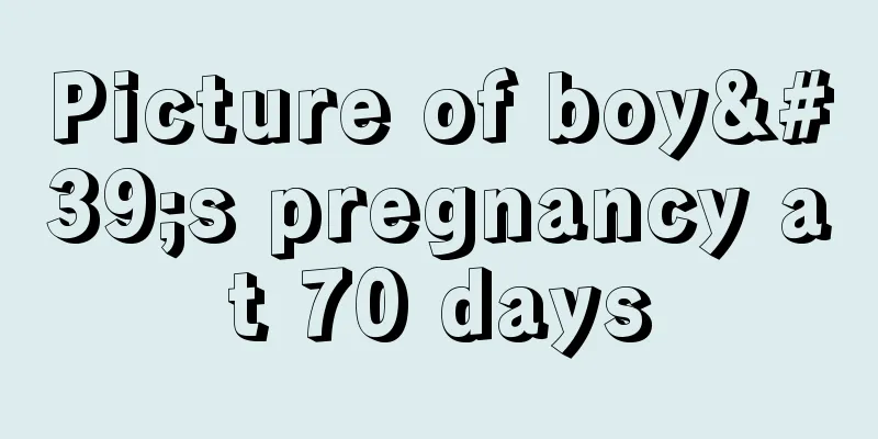 Picture of boy's pregnancy at 70 days