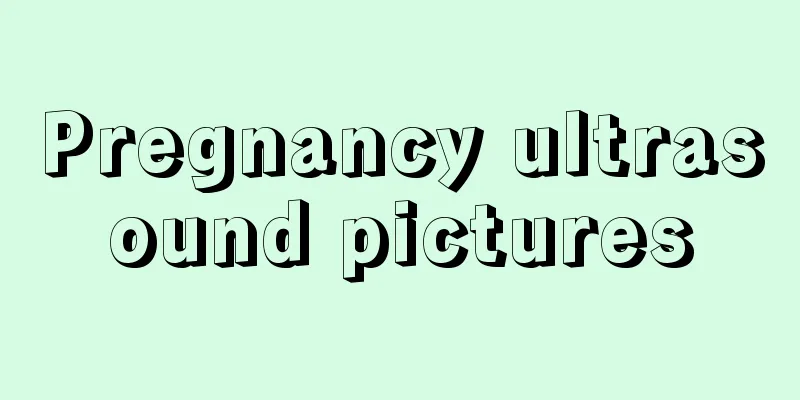 Pregnancy ultrasound pictures