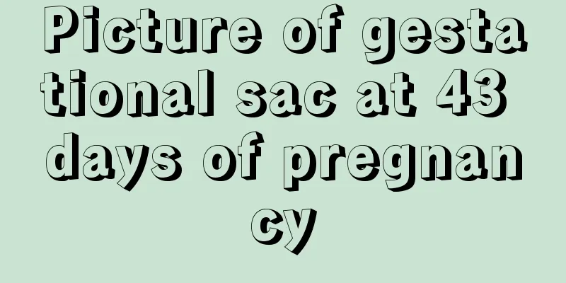 Picture of gestational sac at 43 days of pregnancy