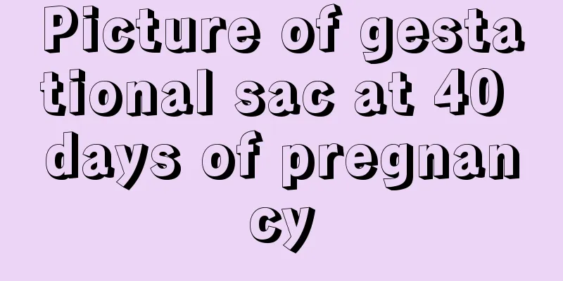 Picture of gestational sac at 40 days of pregnancy