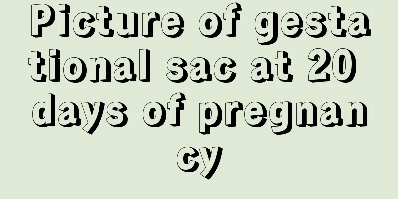 Picture of gestational sac at 20 days of pregnancy