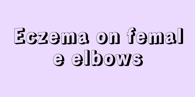 Eczema on female elbows