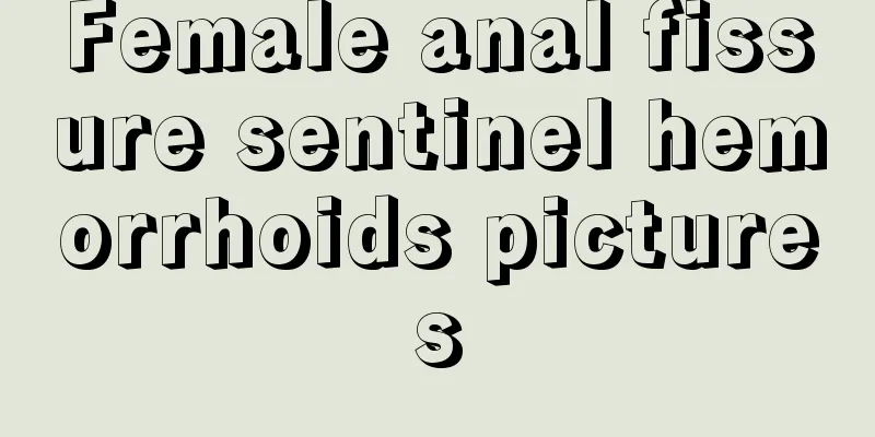 Female anal fissure sentinel hemorrhoids pictures